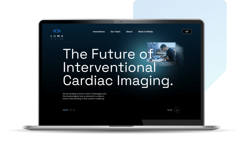 Screenshot of the Luma Vision website displayed in a laptop